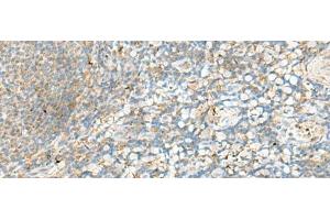 Immunohistochemistry (Paraffin-embedded Sections) (IHC (p)) image for anti-Major Histocompatibility Complex, Class II, DR beta 4 (HLA-DRB4) antibody (ABIN7246559)