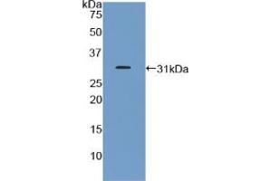Western blot analysis of recombinant Mouse GHR. (Growth Hormone Receptor Antikörper  (AA 36-266))