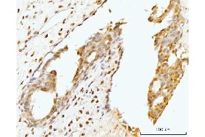 IHC analysis of Nucleostemin/GNL3 using anti-Nucleostemin/GNL3 antibody (ABIN7601778). (Nucleostemin Antikörper  (AA 45-549))