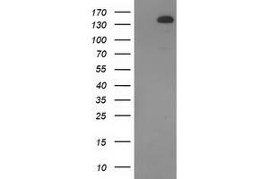 Western Blotting (WB) image for anti-TBC1 Domain Family, Member 4 (TBC1D4) antibody (ABIN1501319) (TBC1D4 Antikörper)