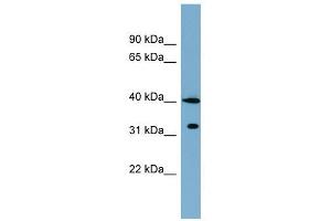 KCTD9 antibody used at 1 ug/ml to detect target protein. (KCTD9 Antikörper  (Middle Region))