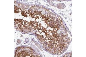 Immunohistochemical staining of human colon with MPP6 polyclonal antibody  shows strong cytoplasmic positivity in glandular cells. (MPP6 Antikörper)