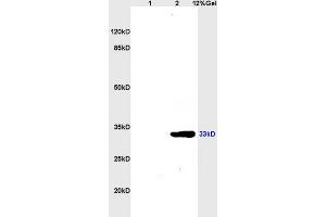 Lane 1: mouse brain lysates Lane 2: mouse kidney lysates probed with Anti CDK4 Polyclonal Antibody, Unconjugated (ABIN671166) at 1:200 in 4 °C. (CDK4 Antikörper  (AA 241-303))