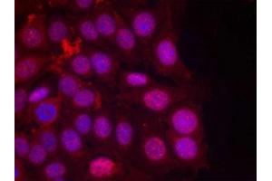 Immunofluorescence staining of methanol-fixed MCF cells using Progesterone Receptor(Phospho-Ser190) Antibody. (Progesterone Receptor Antikörper  (pSer190))