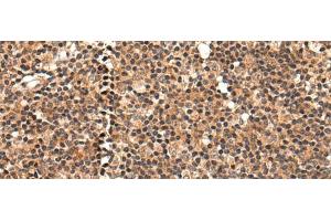 Immunohistochemistry of paraffin-embedded Human tonsil tissue using C16orf45 Polyclonal Antibody at dilution of 1:45(x200) (C16orf45 Antikörper)