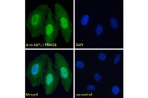 ABIN184913 Immunofluorescence analysis of paraformaldehyde fixed HeLa cells, permeabilized with 0.