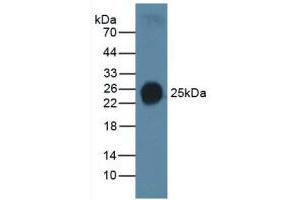 Western blot analysis of Human Serum. (Surfactant Protein C Antikörper  (AA 24-197))