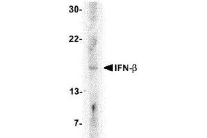 Western Blotting (WB) image for anti-Interferon, beta 1, Fibroblast (IFNB1) (Center) antibody (ABIN2474126) (IFNB1 Antikörper  (Center))