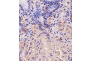 (ABIN650677 and ABIN2838644) staining EIF4E2 in human stomach tissue sections by Immunohistochemistry (IHC-P - paraformaldehyde-fixed, paraffin-embedded sections). (EIF4E2 Antikörper)