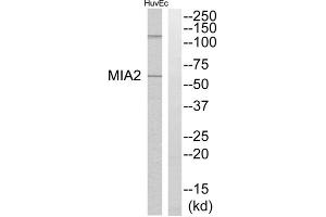 Western blot analysis of extracts from HuvEc cells, using MIA2 antibody. (MIA2 Antikörper  (Internal Region))