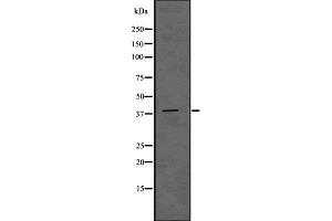 Western blot analysis of ADH6 using HUVEC whole cell lysates (ADH6 Antikörper)