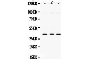 Western Blotting (WB) image for anti-Mitogen-Activated Protein Kinase 13 (MAPK13) (AA 332-365), (C-Term) antibody (ABIN3043610)
