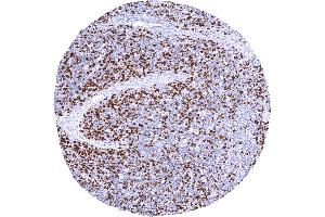 Strong TYMS staining of a large fraction of thymic lymphocytes (Rekombinanter TYMS Antikörper  (Center))