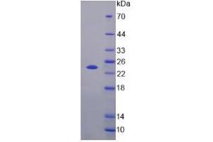 Image no. 1 for Fibroblast Growth Factor 21 (FGF21) (AA 29-209) protein (His tag) (ABIN6237391)