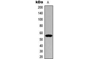 Western blot analysis of Cytochrome P450 21A2 expression in HeLa (A) whole cell lysates. (CYP21A2 Antikörper  (Center))
