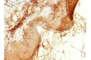Immunohistochemistry of paraffin-embedded human skin tissue using ABIN7151902 at dilution of 1:100 (EPS15L1 Antikörper  (AA 585-864))