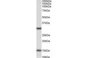 Western Blotting (WB) image for anti-Sirtuin 3 (SIRT3) (Internal Region) antibody (ABIN2464493)