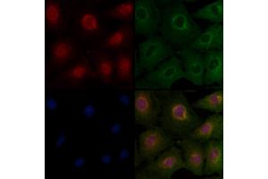 ABIN6263554 and ABIN6277124 staining  cells by IF/ICC. (NDRG1 Antikörper  (C-Term))