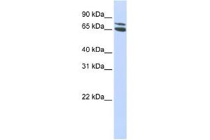 WB Suggested Anti-ZBTB48 Antibody Titration: 0. (ZBTB48 Antikörper  (Middle Region))