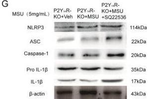 Decreased cAMP exaggerated acute gouty arthritis in P2Y14R-KO rats. (NLRP3 Antikörper  (AA 15-120))