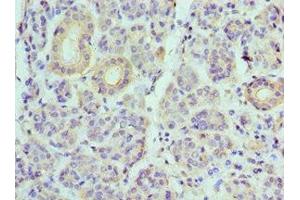 Immunohistochemistry (IHC) image for anti-ATPase, H+ Transporting, Lysosomal 56/58kDa, V1 Subunit B1 (ATP6V1B1) (AA 1-280) antibody (ABIN7175230)