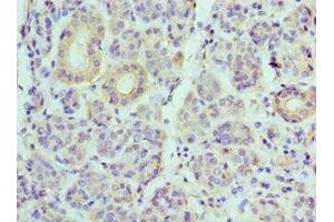 Immunohistochemistry of paraffin-embedded human salivary gland tissue using ABIN7175230 at dilution of 1:100 (ATP6V1B1 Antikörper  (AA 1-280))