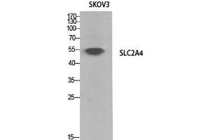 Western Blot analysis of SKOV3 cells using GLUT-4 Polyclonal Antibody at dilution of 1:1000. (GLUT4 Antikörper)