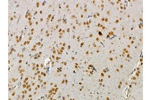 ABIN7095010 and ABIN7099066 at 1/100 staining rat brain tissue by IHC-P.