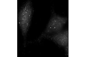 Immunofluorescence staining of Autophagy UVRAG antibody (ABIN388588 and ABIN2849986) on Methanol-fixed HeLa cells. (UVRAG Antikörper  (AA 120-152))