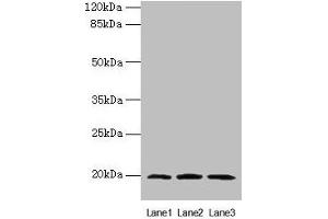 Western blot All lanes: MRPL49 antibody at 0. (MRPL49 Antikörper  (AA 1-166))