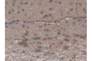 DAB staining on IHC-P; Samples: Rat Brain Tissue (FAS Antikörper  (AA 21-170))