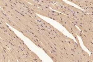 Immunohistochemistry analysis of paraffin-embedded mouse heart using,PYM (ABIN7074992) at dilution of 1: 6000 (Partner of Y14 and Mago (PYM1) Antikörper)