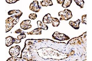 IHC analysis of PDIA6 using anti-PDIA6 antibody (ABIN7600554). (PDIA6 Antikörper  (AA 20-440))