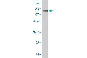 Western Blotting (WB) image for anti-Transcription Factor 7-Like 2 (T-Cell Specific, HMG-Box) (TCF7L2) (AA 1-455) antibody (ABIN563117)