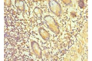 Immunohistochemistry of paraffin-embedded human small intestine tissue using ABIN7164900 at dilution of 1:100 (TAC1 Antikörper  (AA 1-129))