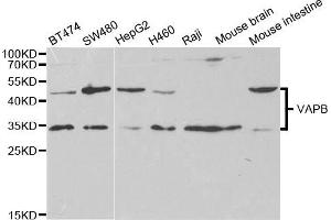 Western blot analysis of extracts of various cell lines, using VAPB antibody (ABIN5973099) at 1/1000 dilution.