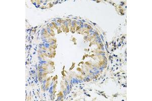 Immunohistochemistry of paraffin-embedded mouse lung using NCR3 antibody (ABIN5974302) at dilution of 1/100 (40x lens). (NCR3 Antikörper)