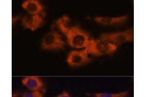 Immunofluorescence analysis of C6 cells using NDRG4 Polyclonal Antibody at dilution of 1:100. (NDRG4 Antikörper)