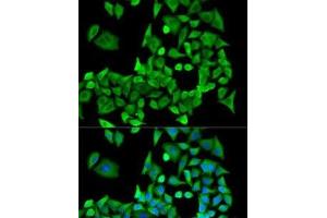 Immunofluorescence analysis of U2OS cells using PPP2R1A Polyclonal Antibody (PPP2R1A Antikörper)