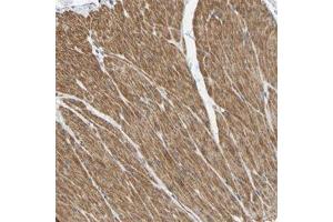 Immunohistochemical staining (Formalin-fixed paraffin-embedded sections) of human smooth muscle with ELMO2 polyclonal antibody  shows cytoplasmic positivity in smooth muscle cells.