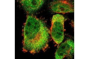 Immunofluorescent staining of U-251 MG with FOXP4 polyclonal antibody  (Green) shows positivity in cytoplasm and nucleus but excluded from the nucleoli.
