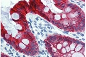 Colon, Human: Formalin-Fixed, Paraffin-Embedded (FFPE) (Cytokeratin 18 Antikörper)