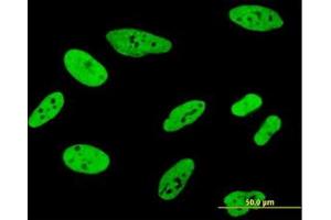 Image no. 5 for anti-Far Upstream Element (FUSE) Binding Protein 1 (FUBP1) (AA 27-137) antibody (ABIN599075) (FUBP1 Antikörper  (AA 27-137))