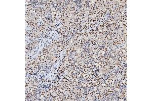 IHC analysis of SNRNP200 using anti-SNRNP200 antibody (ABIN7602032). (SNRNP200 Antikörper  (AA 557-2129))