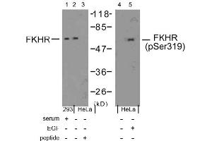 Image no. 1 for anti-Forkhead Box O1 (FOXO1) (Ser319) antibody (ABIN197367) (FOXO1 Antikörper  (Ser319))