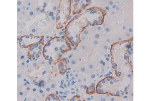 Used in DAB staining on fromalin fixed paraffin- embedded kidney tissue (PLSCR4 Antikörper  (AA 1-303))