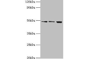 Western blot All lanes: ATP-dependent RNA helicase DDX39A antibody at 2 μg/mL Lane 1: A431 whole cell lysate Lane 2: 293T whole cell lysate Lane 3: HepG2 whole cell lysate Secondary Goat polyclonal to rabbit IgG at 1/10000 dilution Predicted band size: 50, 37, 31 kDa Observed band size: 50 kDa (DDX39 Antikörper  (AA 178-427))
