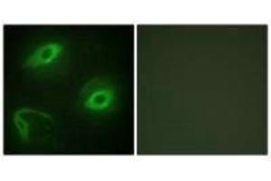 Immunofluorescence analysis of HeLa cells, using LATH antibody. (BPIFA4P Antikörper)
