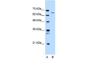 WB Suggested Anti-IVL Antibody Titration:  0.