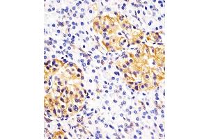 (ABIN390772 and ABIN2841030) staining Hsp 60 in human pancreas sections by Immunohistochemistry (IHC-P - paraformaldehyde-fixed, paraffin-embedded sections). (HSPD1 Antikörper  (N-Term))
